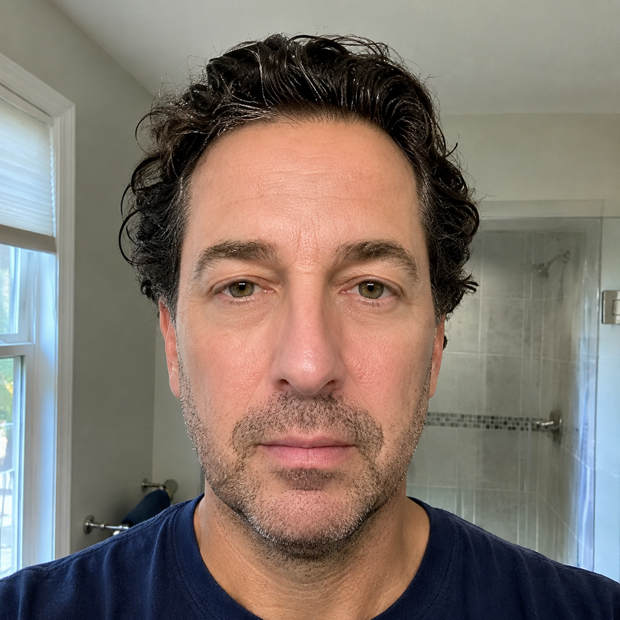 Mark W. after using RESTED Eye Repair Stick